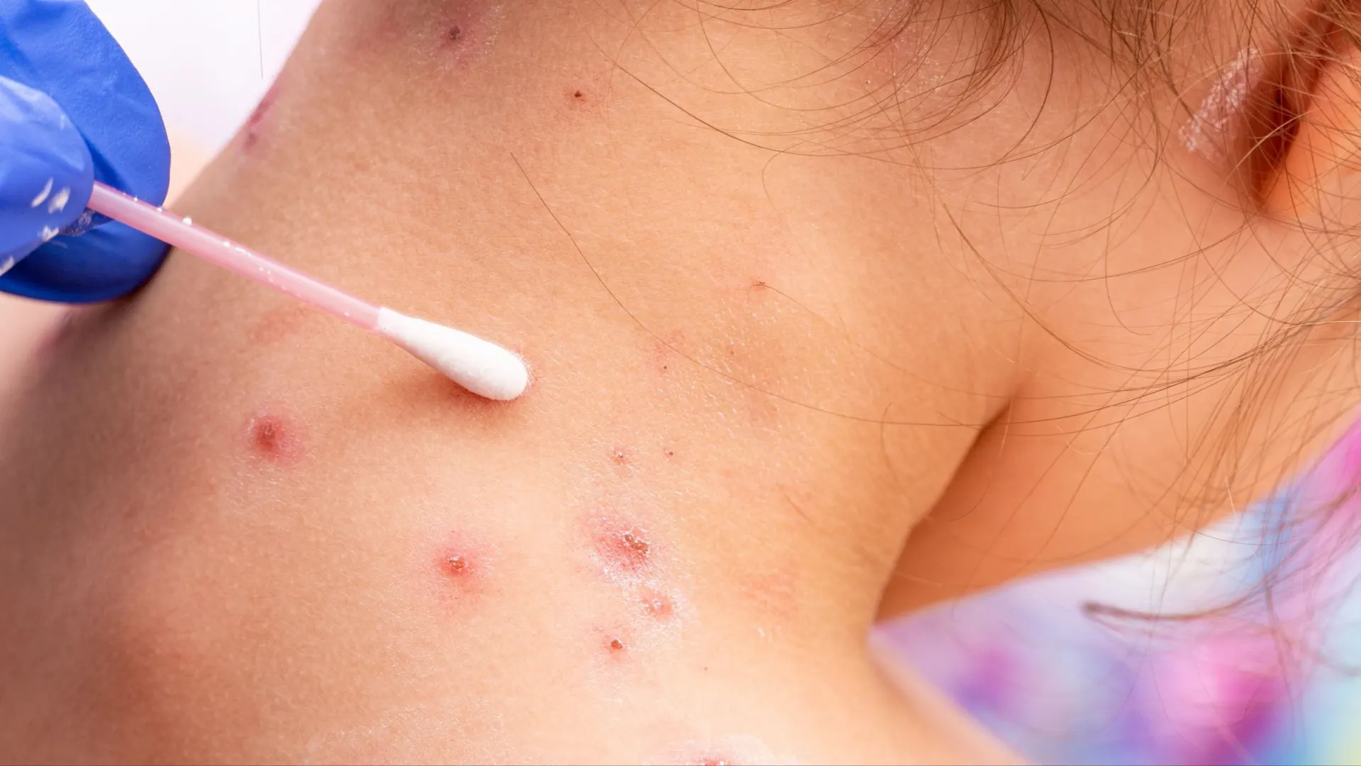 Фото: Vitalis83/Shutterstock/Fotodom