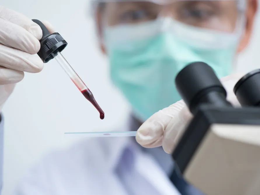 Густая кровь: причины и методы лечения — что делать?